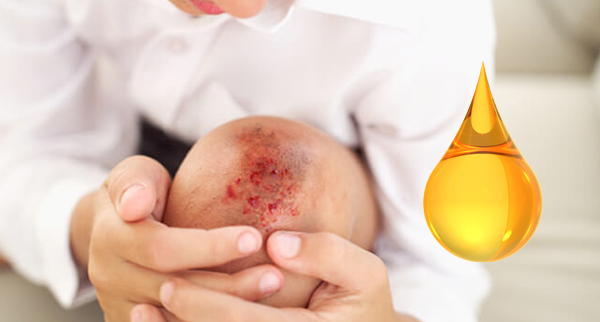 ajwain oil cleaning open wounds